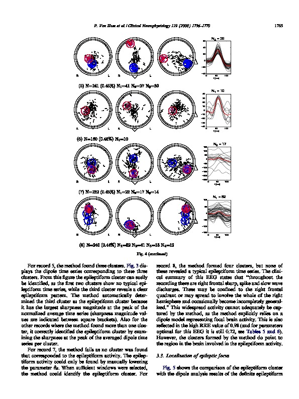 Download Detection of focal epileptiform events in the EEG by spatio-temporal dipole clustering.